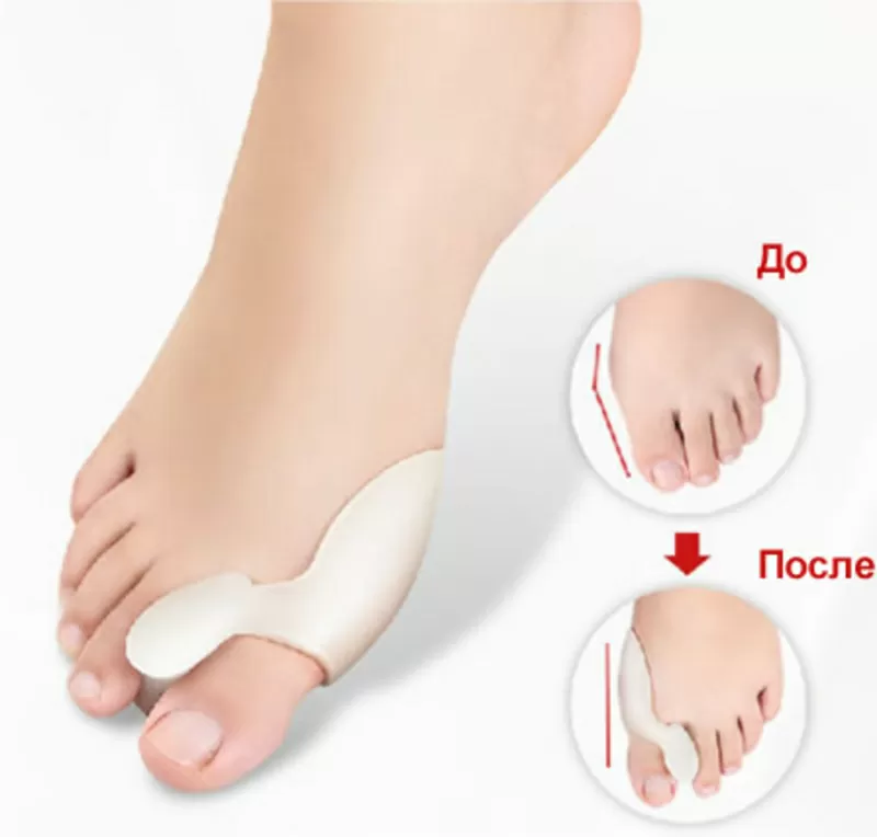 VALGUS PRO в Беларуси 2