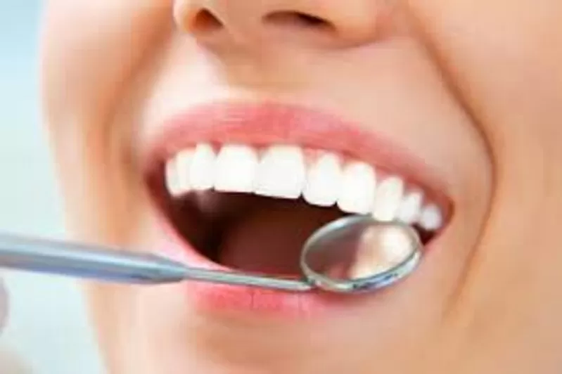 Профессиональная чистка зубов,  отбеливание ультразвуком 6